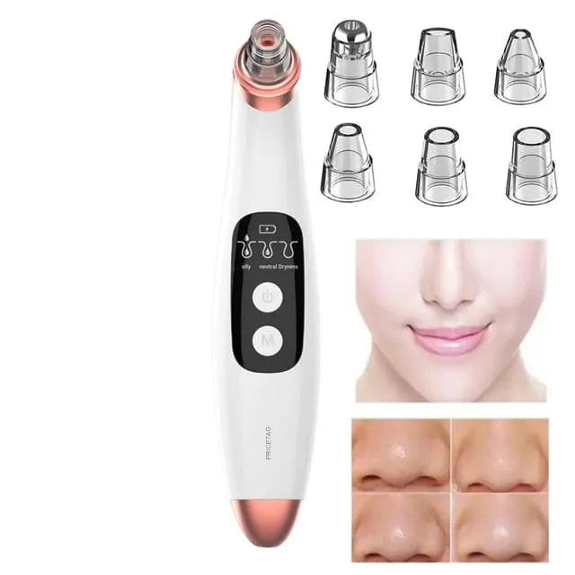 6 in 1 Electric Blackhead Acne Oil Remover Vacuum Suction Face Pore Cleaner, Black Head Remover