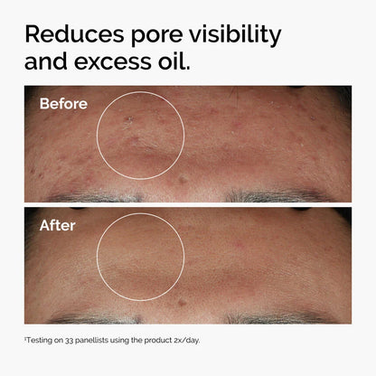 Niacinamide 10% + Zinc 1% | THE ORDINARY